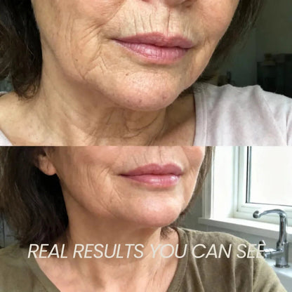 🔥LAST DAY 50% OFF! Anti-aging Calcium Volume Multi Balm✨