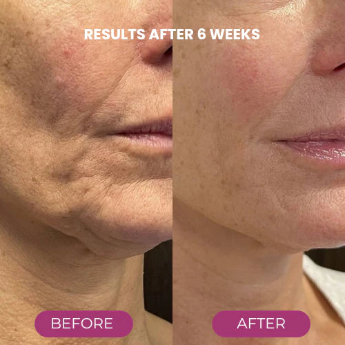 🔥LAST DAY 50% OFF! Anti-aging Calcium Volume Multi Balm✨