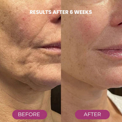 🔥LAST DAY 50% OFF! Anti-aging Calcium Volume Multi Balm✨