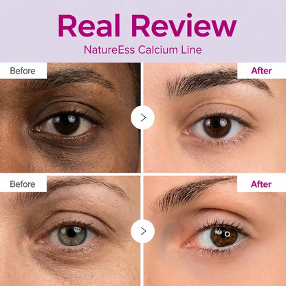NatureEss Korean Calcium Dark Spot Eye Cream