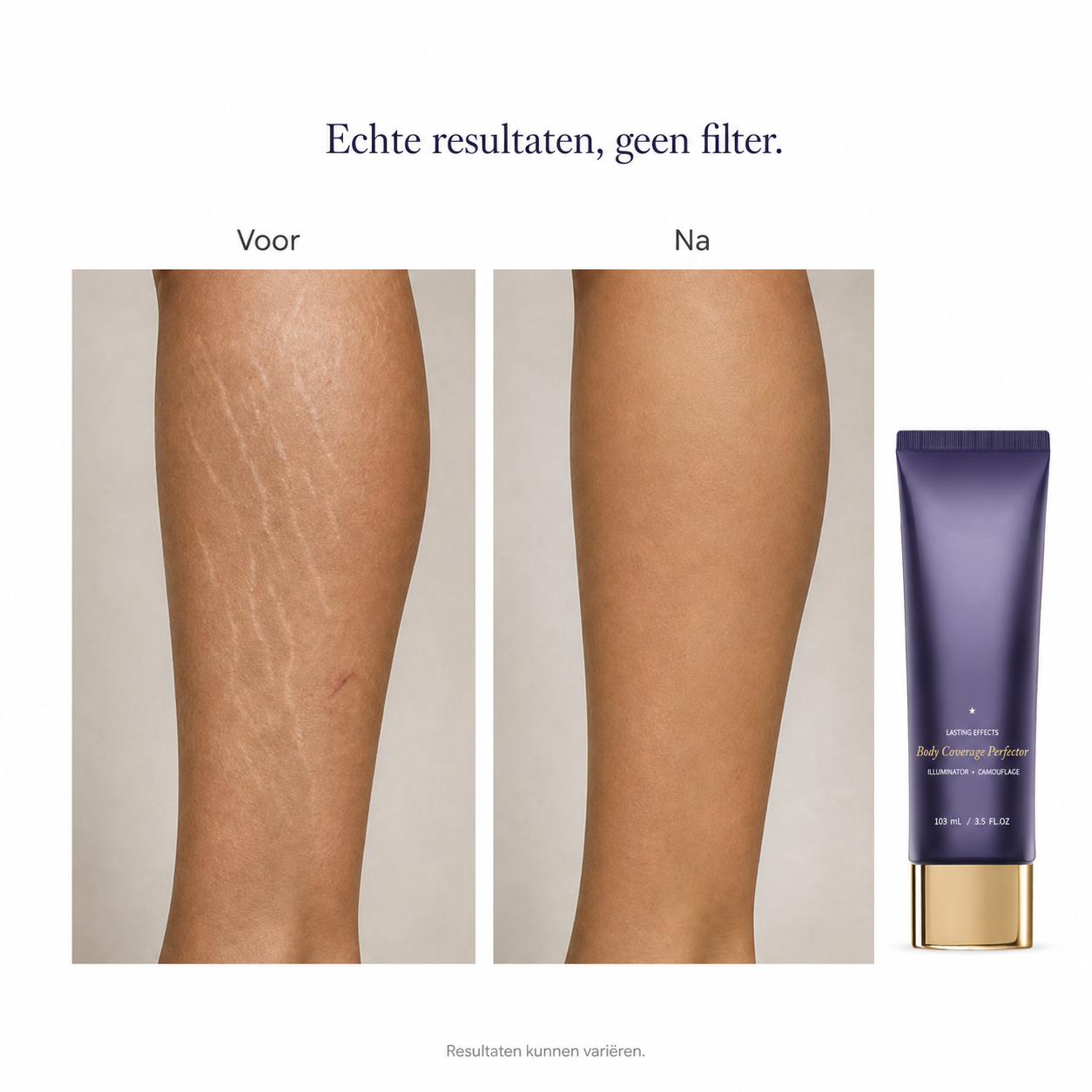 🔥 LIMITED TIME OFFER | Velure Body Sumlory™