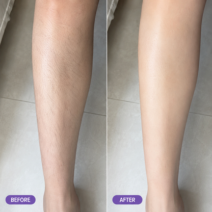 🔥Buy 2 get 1 free | Spray Hair Removal Mousse for Sensitive Skin