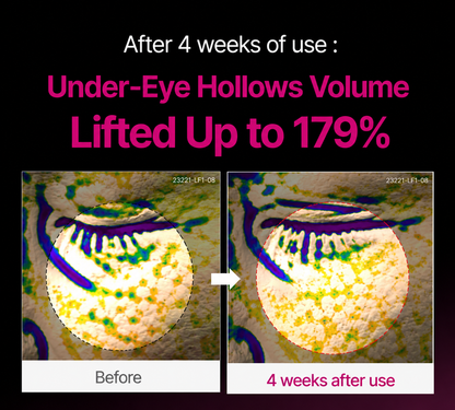 NatureEss Korean Calcium Dark Spot Eye Cream