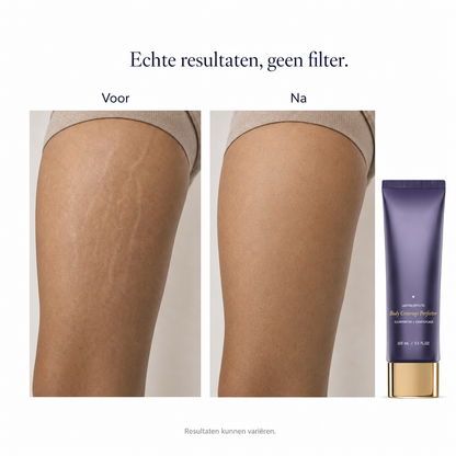 🔥 LIMITED TIME OFFER | Velure Body Sumlory™
